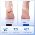 Electric foot grinder for removing dead skin and heel grinding stones 245